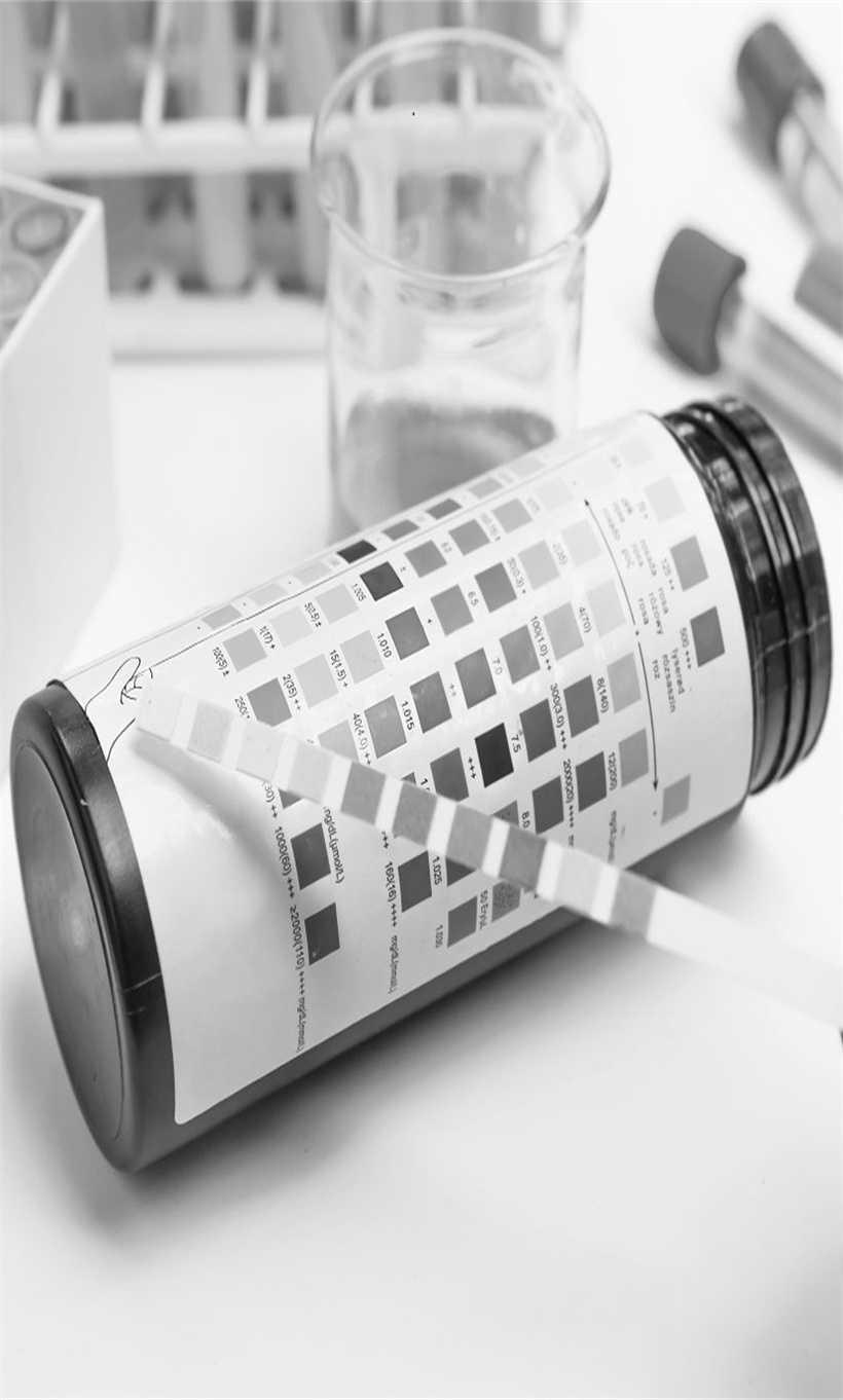 Système d'analyse d'urine